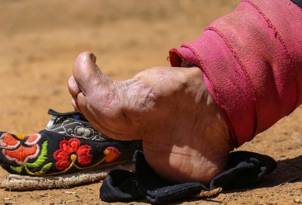 Does Chinese Foot Binding Still Impact Society Today?