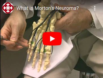 M is for Mortons Neuroma