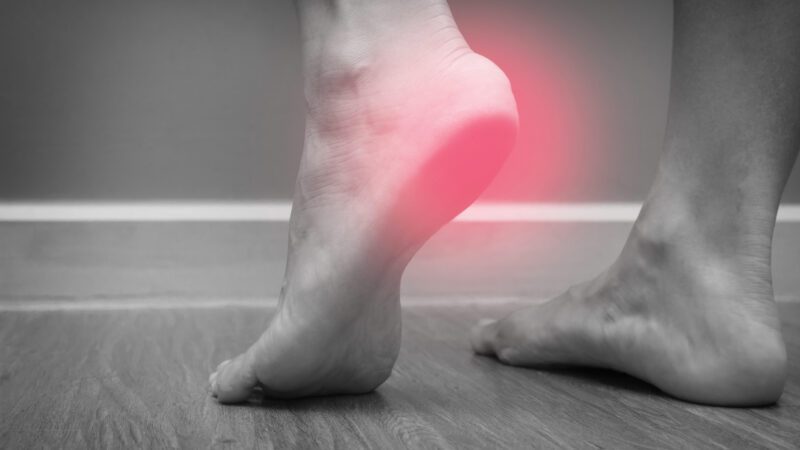 Plantar Fasciitis – how then do you treat it?