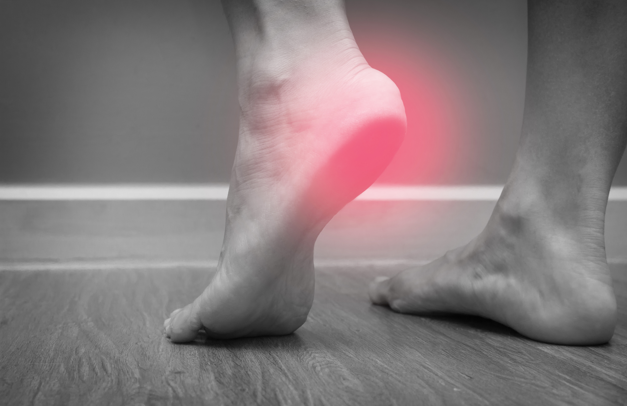Plantar Fasciitis – how then do you treat it?