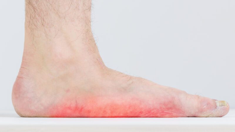 The Supination Resistance Test